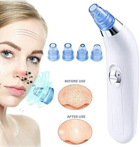 Blackhead Remover
