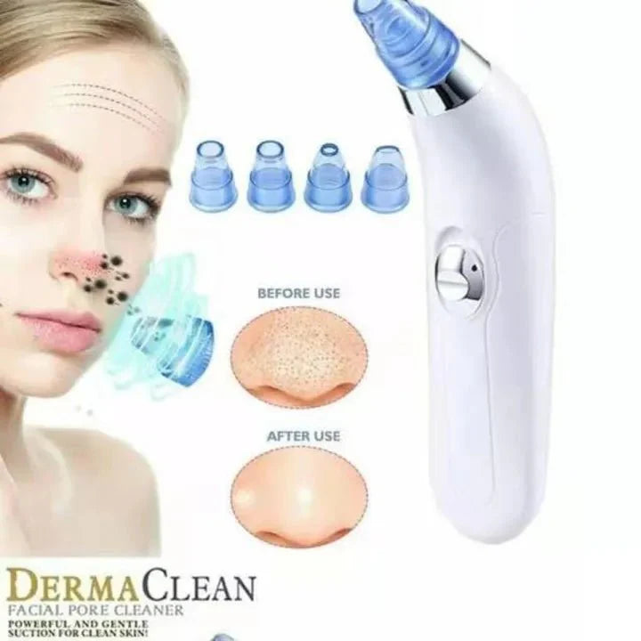 Blackhead Remover