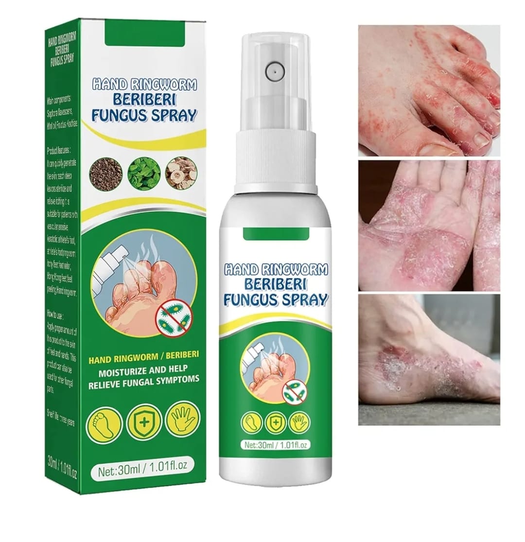 Hand Ringworm Beriberi Fungus Spray (Original)