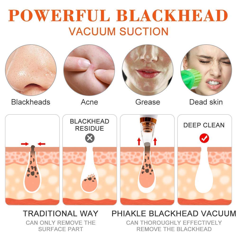 Multi-Functional Blackhead Remover