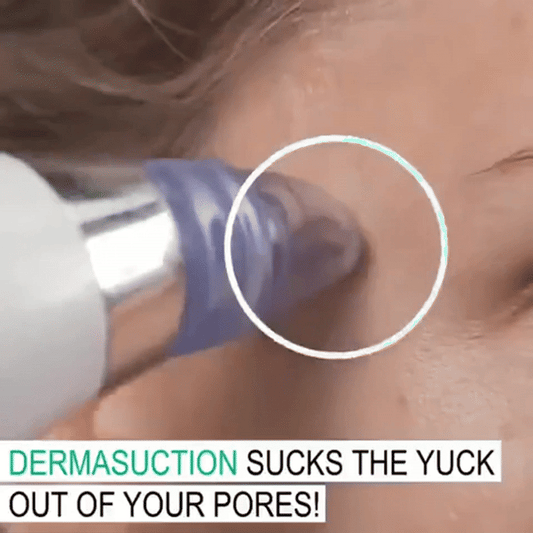 Blackhead Remover