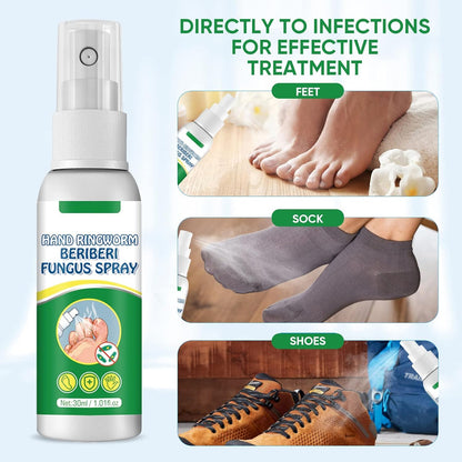 Hand Ringworm Beriberi Fungus Spray (Original)