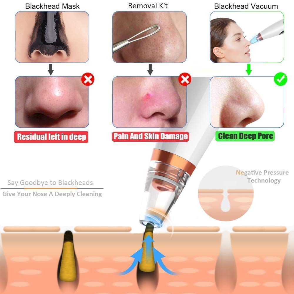 Multi-Functional  Blackhead Remover